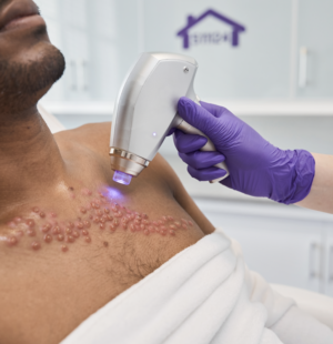 Herpes Shingles Management in Nagpur