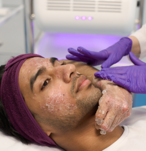 Psoriasis Eczema Treatment in Nagpur